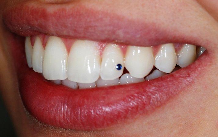 Denti nei sogni. Cosa significa sognare di perdere i denti